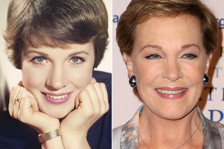 julie andrews plastic surgery Image 3